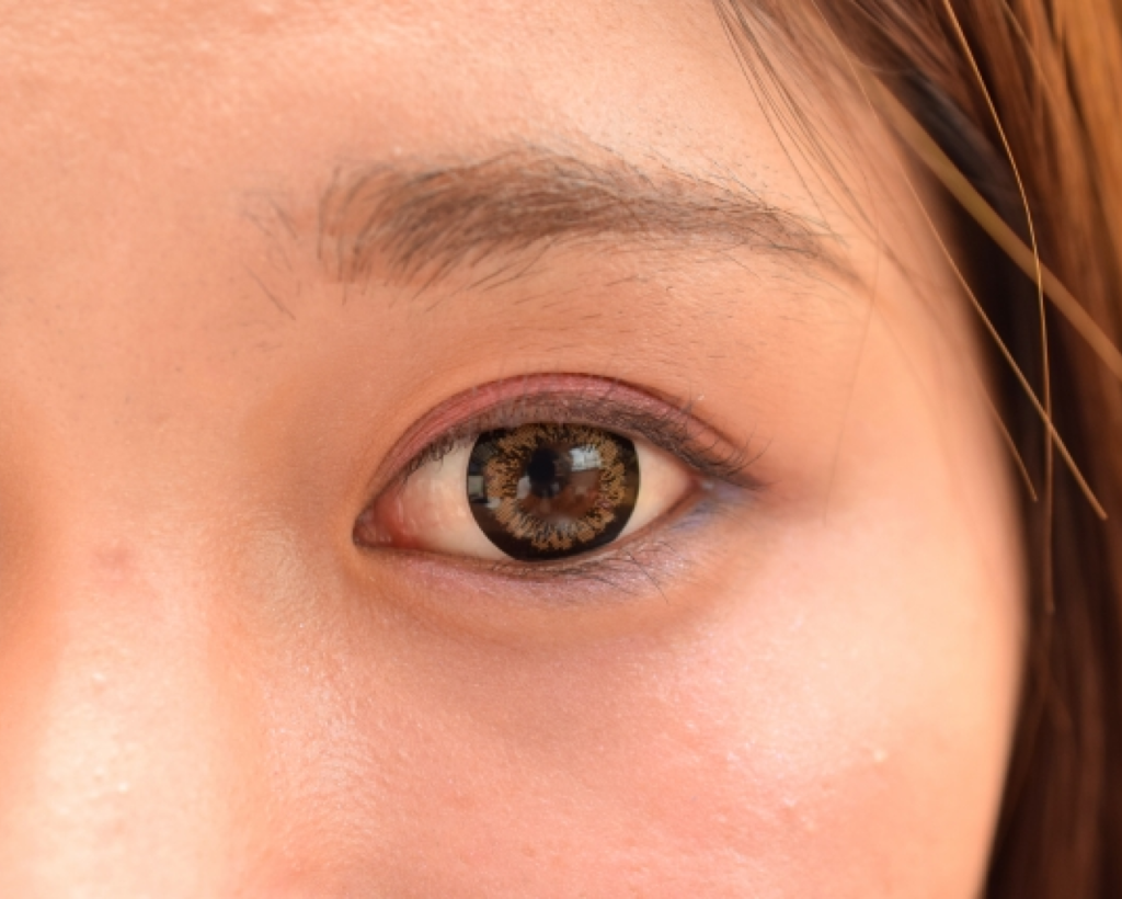 衰えることで目のたるみの原因となる、眼窩脂肪の画像